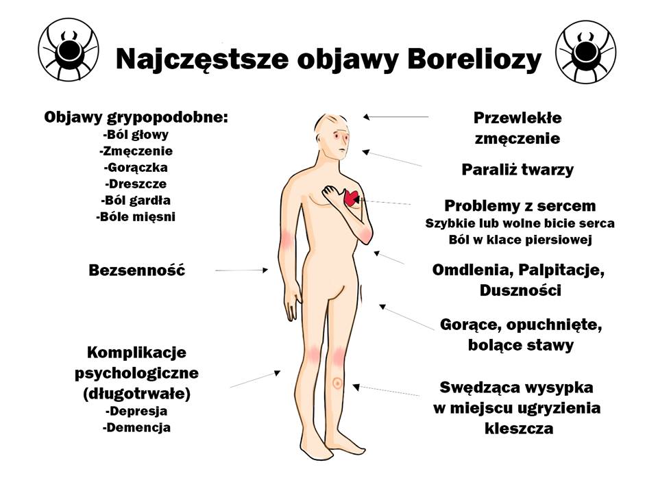 Jak sprawdzić czy mam boreliozę?